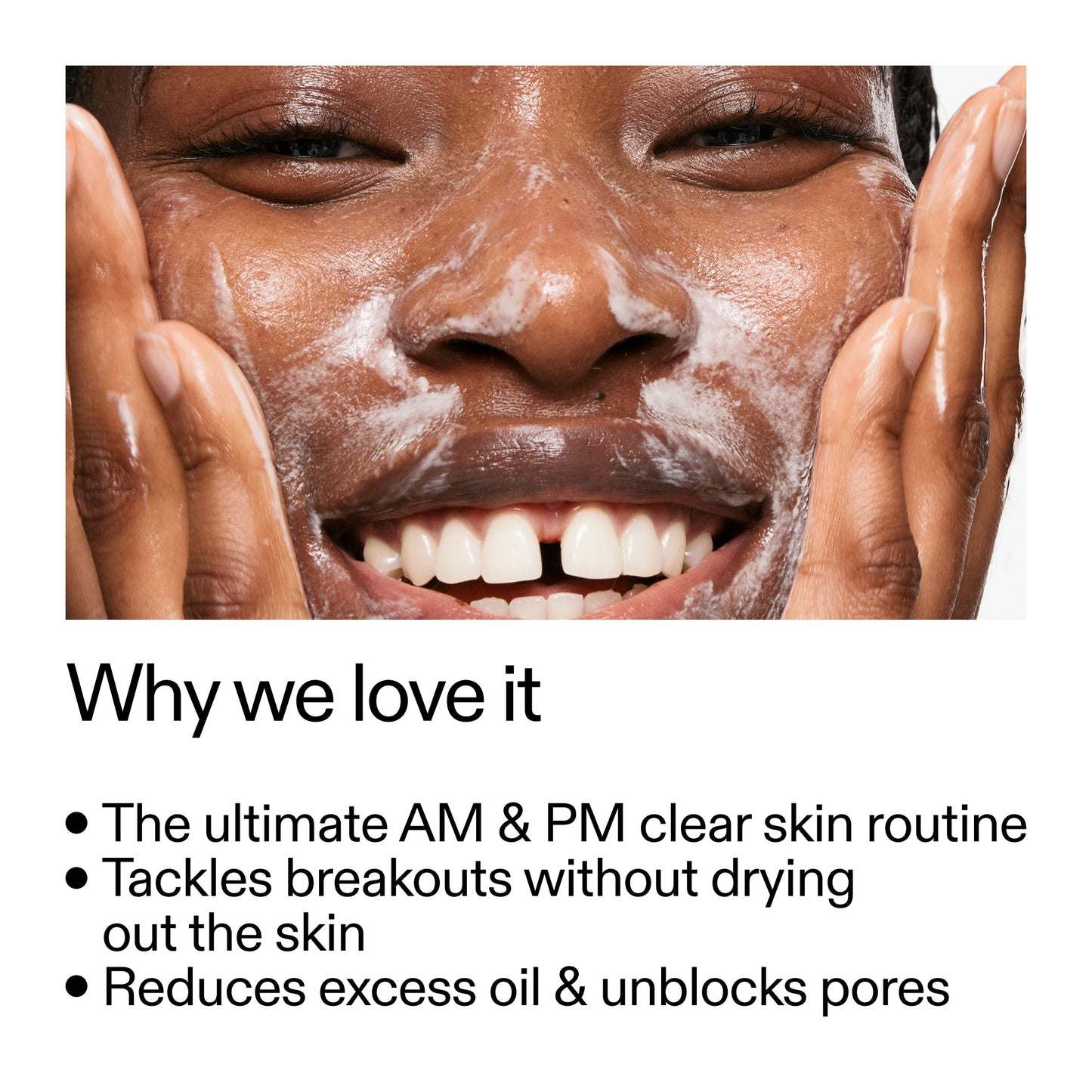 intro-routine-for-acne-q3 Intro_Routine_for_Acne_Why_we_love_it_2000x2000_42499e10-4629-4a0e-a627-7e215f4da6bc.jpg