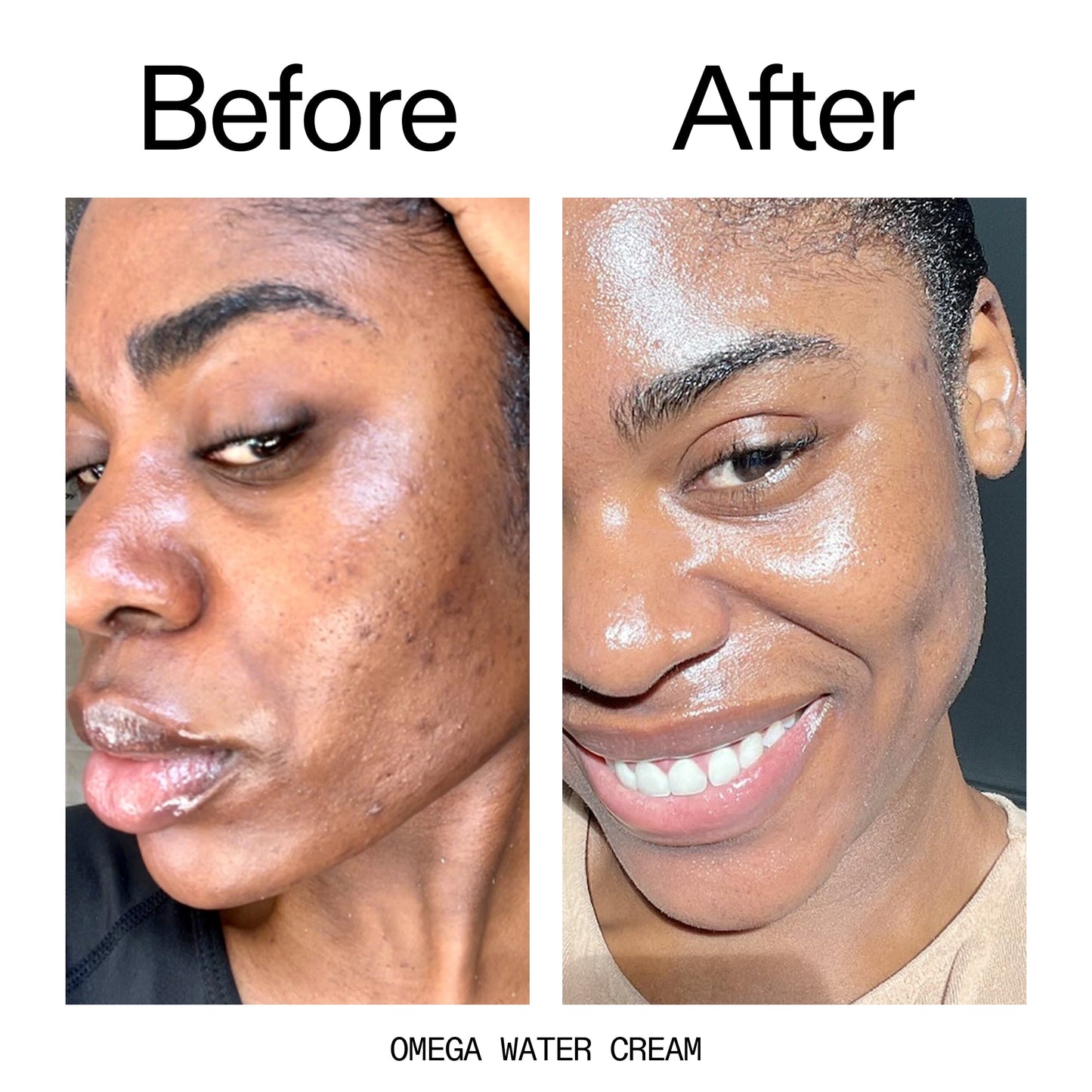 glowing-skin-set-m9 Omega_Water_Cream_Before_After_2000x2000_8e88278b-8c8d-48dc-ac77-4e98ebbd1b77.jpg