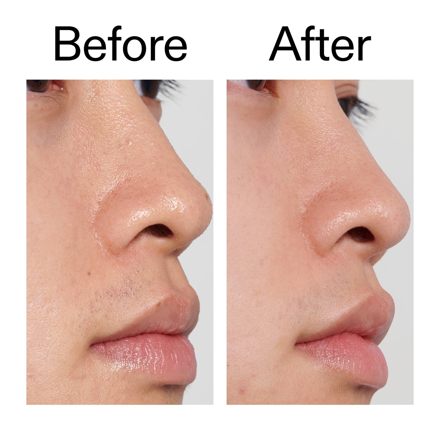 pha-toner-y2 PHA_Toner_Before_After_2000x2000_e3c10172-0150-4342-8b95-57417eaff50d.jpg