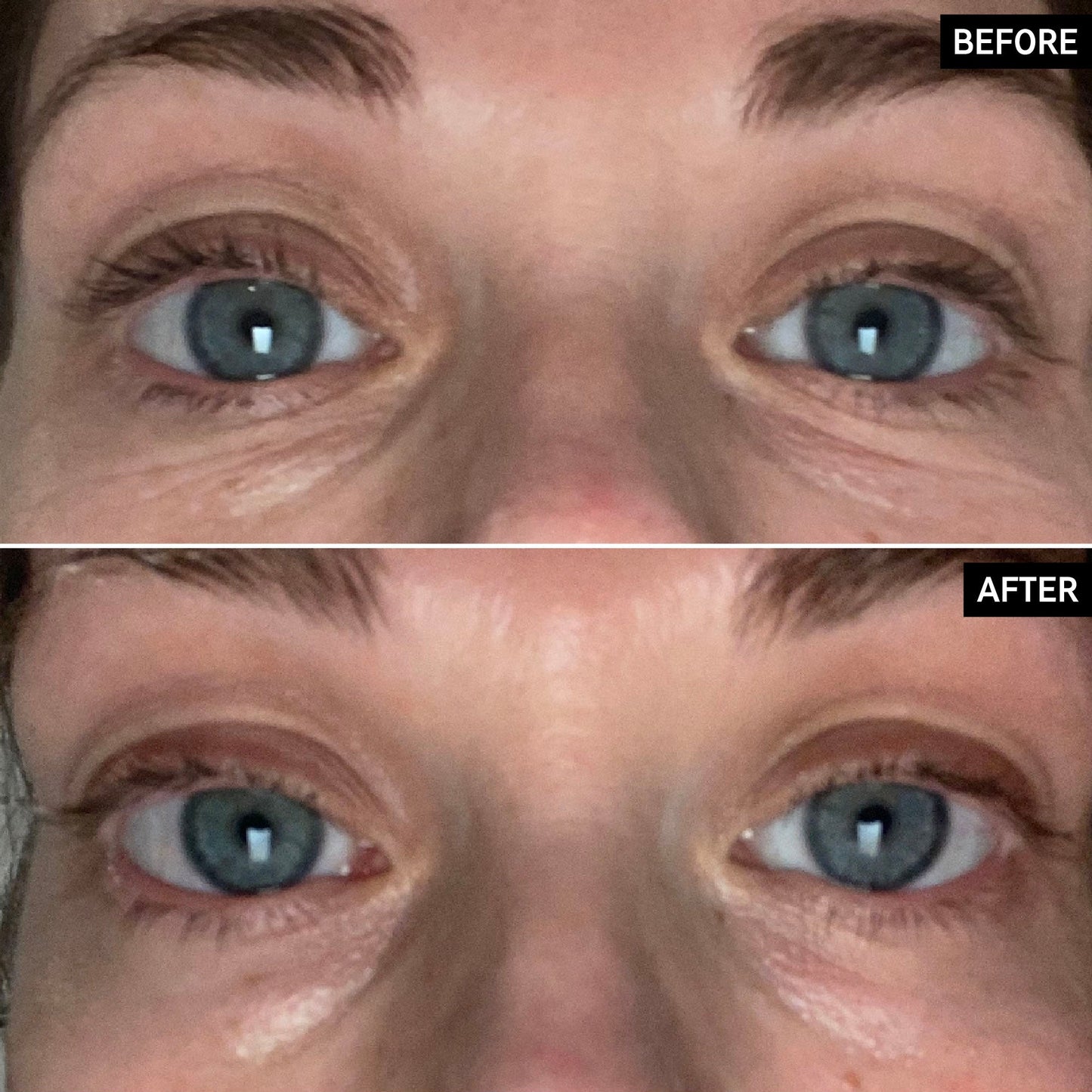 retinol-eye-cream-x6 SITE-UGCBAsApril_Nicole_B_A_PPage_2000x2000_1.jpg