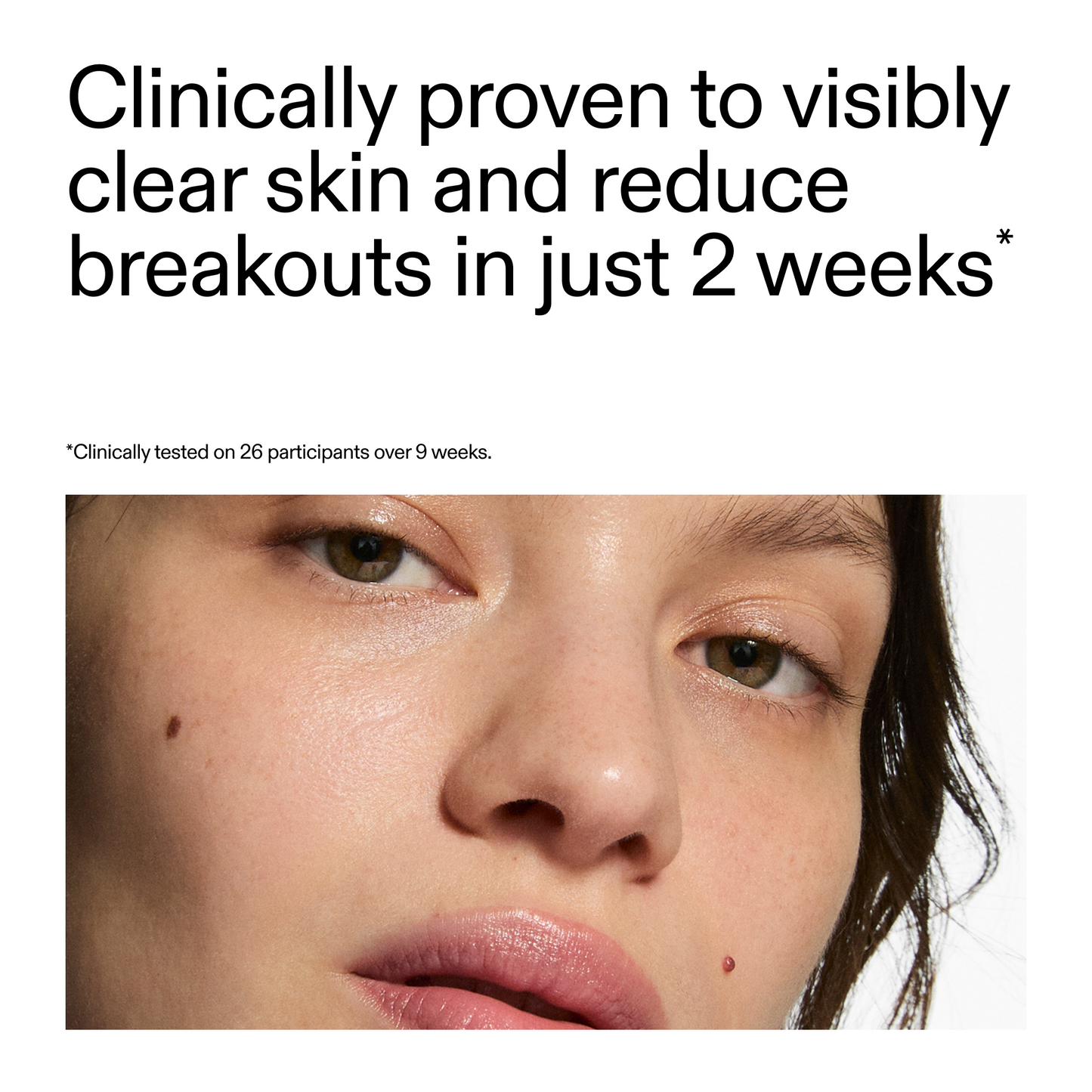 360-acne-clearing-duo-d5 360_Serum_Key_Claim.png