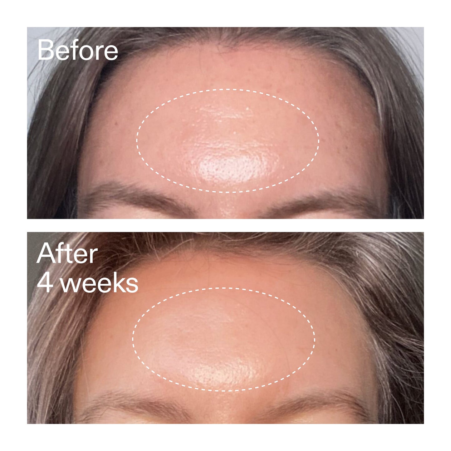 advanced-0-2-retinal-serum-duo-f4 AdvancedRetinal_BeforeAfter1_2000x2000_4e9c798a-f30e-45b8-a34a-7c4740f2f2cb.jpg