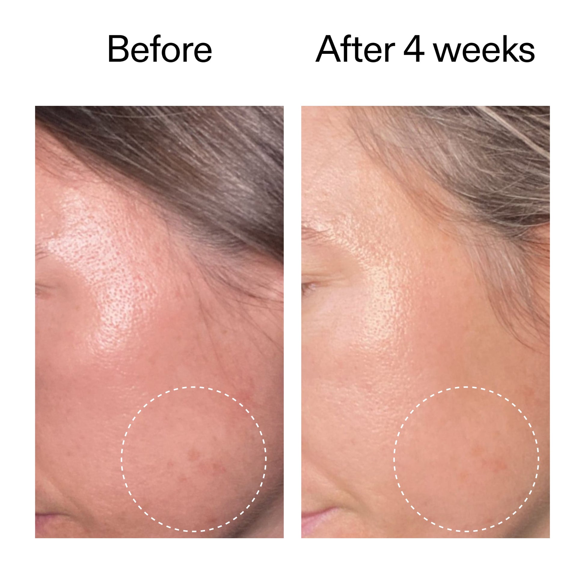 advanced-0-2-retinal-serum-k2 AdvancedRetinal_BeforeAfter2__2000x2000_62fb16bb-77ae-4d63-8500-88dbf847f4b9.jpg