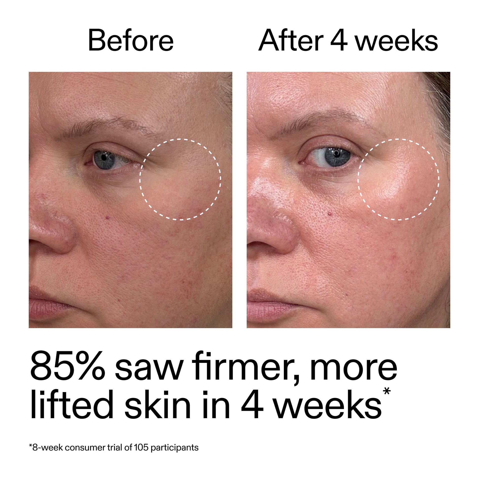 advanced-0-2-retinal-serum-k2 AdvancedRetinal_BeforeAfter_Claim1_2000x2000_bcc385c4-5e73-4f1e-aba8-64267937d0d3.jpg