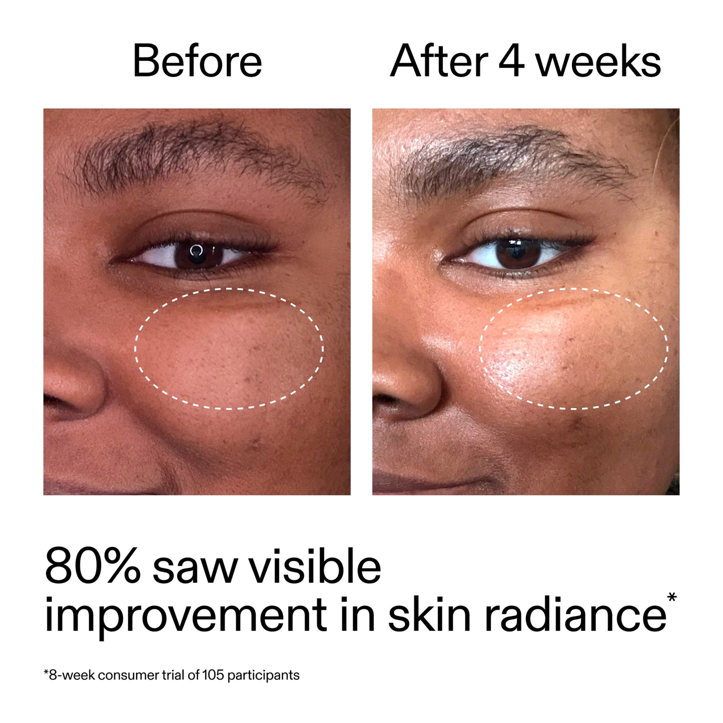 advanced-0-2-retinal-serum-k2 AdvancedRetinal_BeforeAfter_Claim2_2000x2000_39d11e3d-eda9-44ec-ab32-2903b1a368bd.jpg