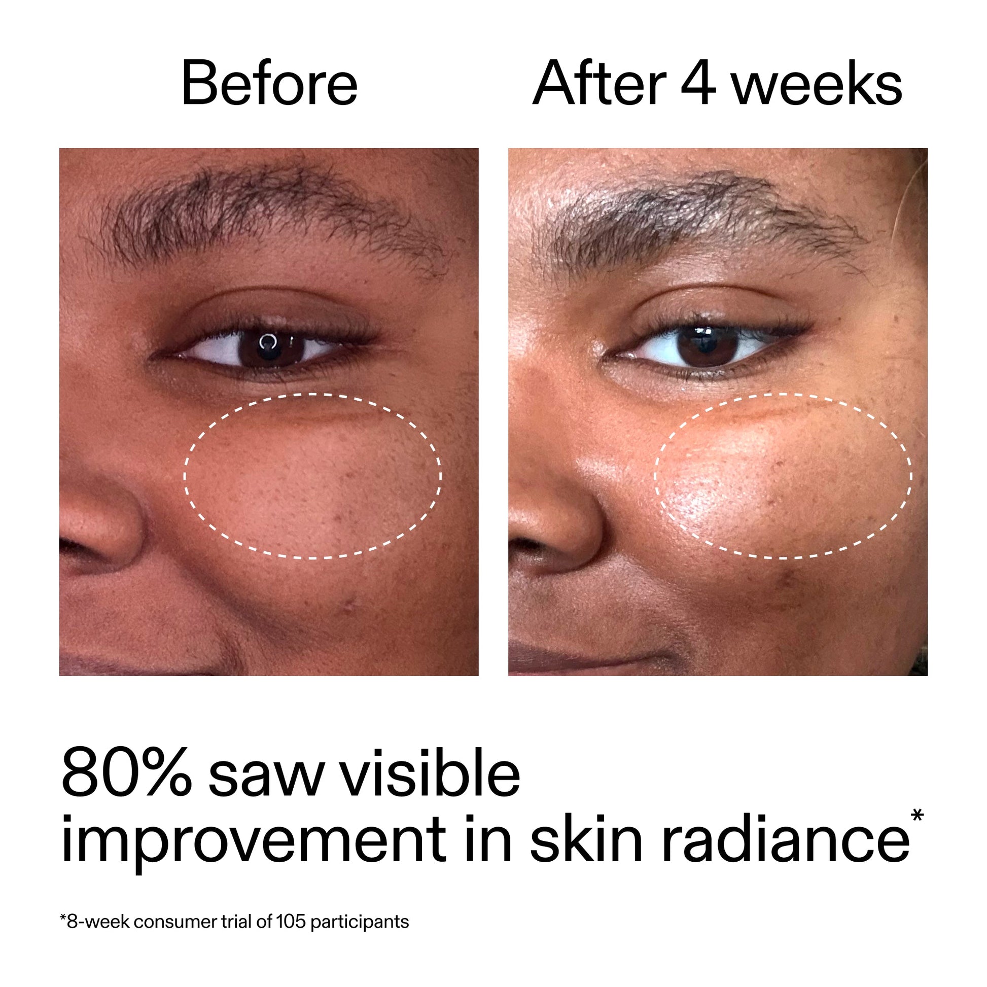 advanced-0-2-retinal-serum-duo-f4 AdvancedRetinal_BeforeAfter_Claim2_2000x2000_681b621d-8d44-4d44-9a40-89244f9b2e53.jpg