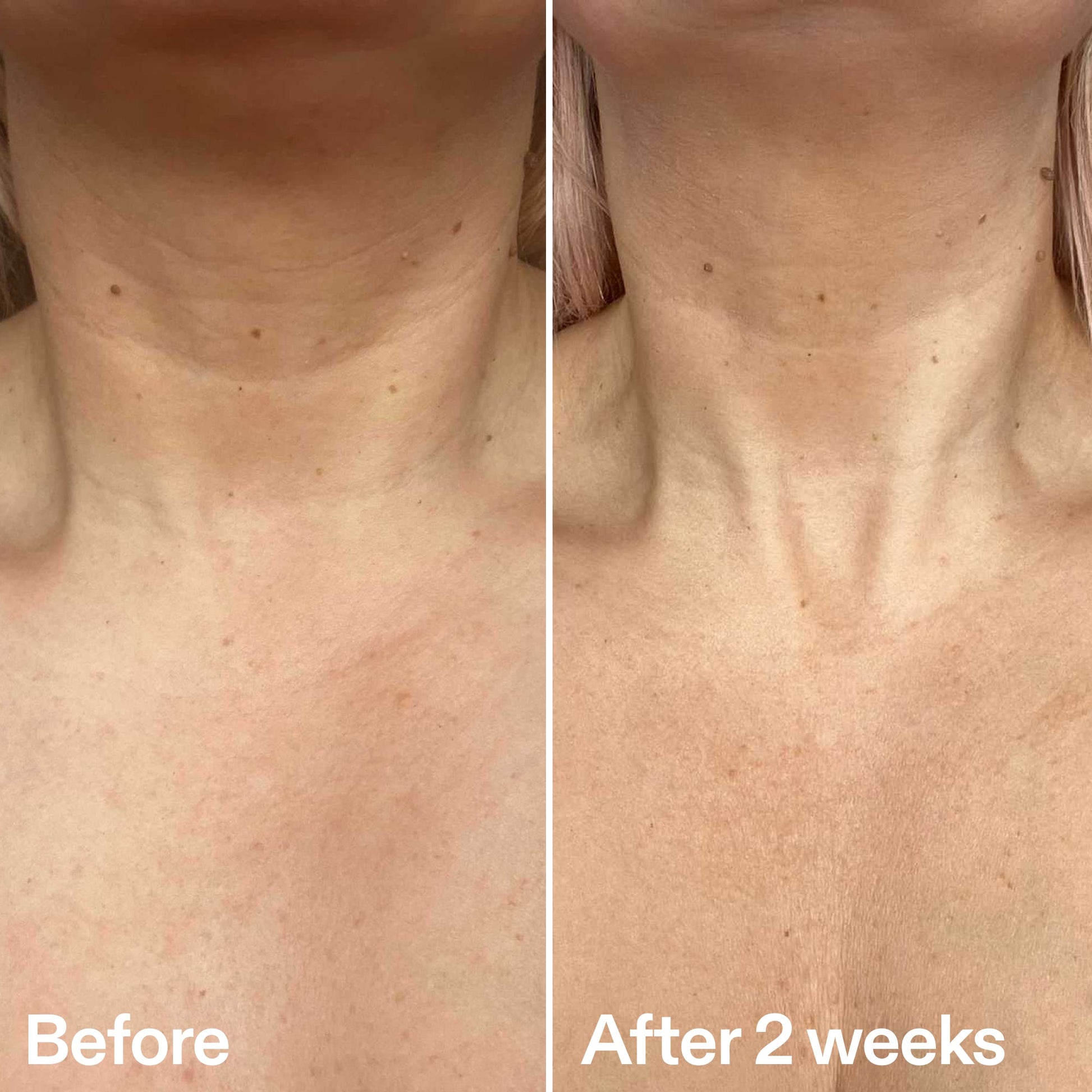 bio-active-neck-lift-stick-r0 B_A_2.jpg