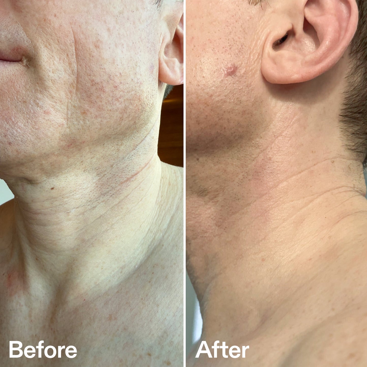 bio-active-neck-lift-stick-r0 B_A_afa2743e-b8e2-4504-92f4-e281cb6cf759.jpg