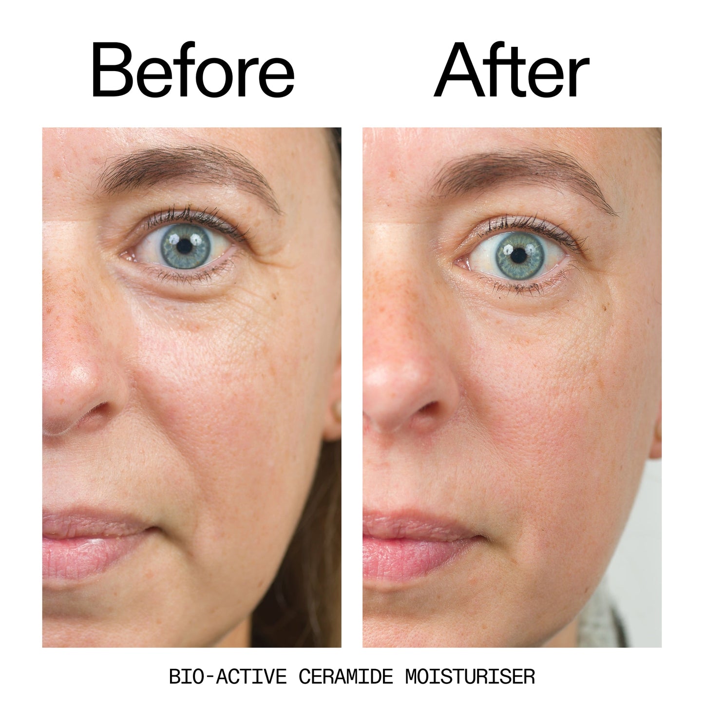 barrier-boosting-trio-q3 Bio-Active_Before_After_2000x2000_600947b4-e8c5-425a-9155-fc15bc83aa12.jpg