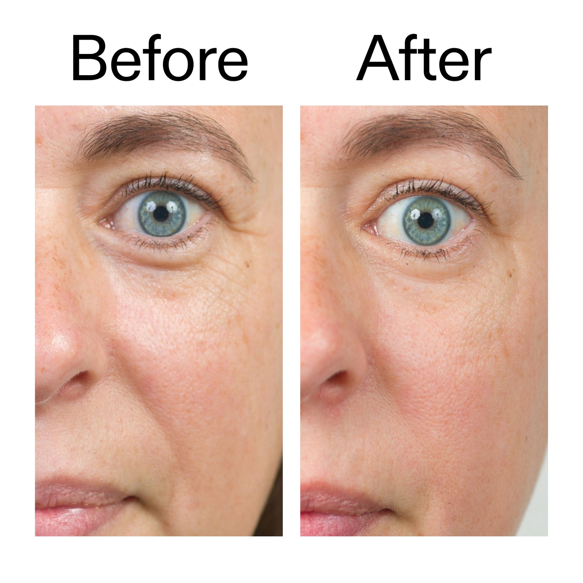 bio-active-ceramide-moisturizer-a3 Bio-Active_Before_After_2000x2000_566e5a9e-135e-417a-8242-b44e5fa35463.jpg