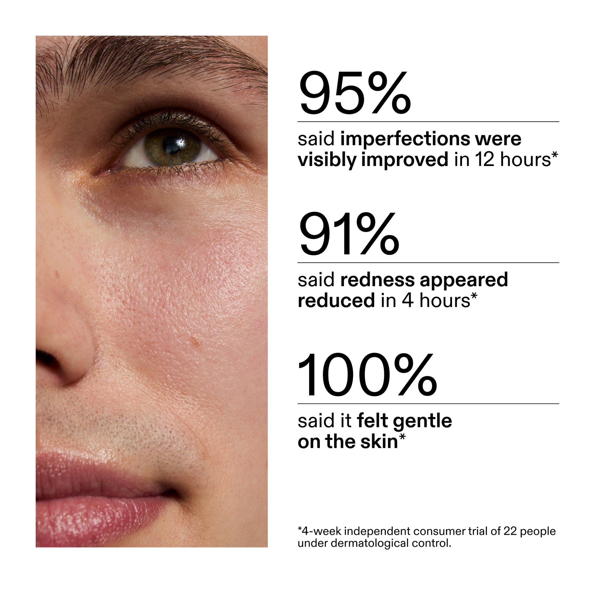 succinic-acid-acne-treatment-k6 CA_Succinic_Acid_Treatment_key_Claims_2000x2000_db91b0f1-7f29-4bfe-bb16-63a47f500960.jpg