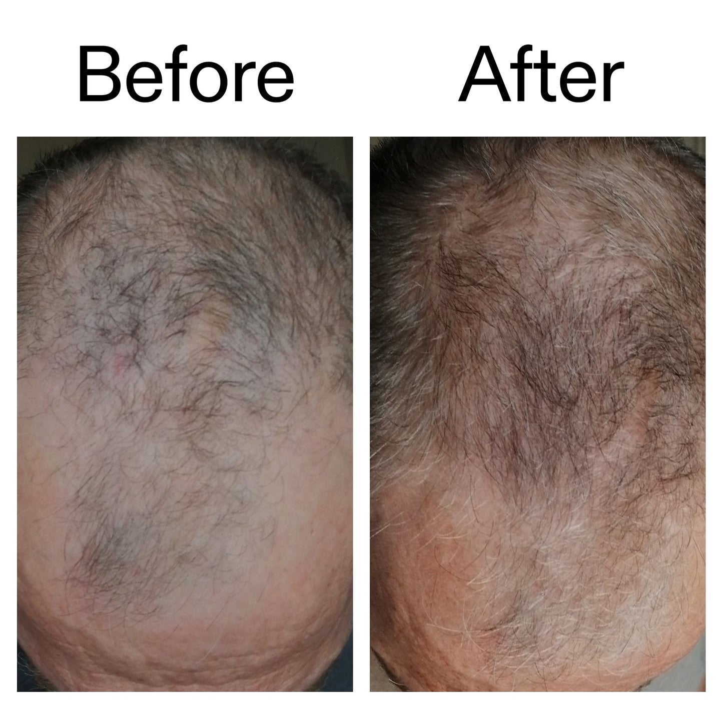 3-month-hair-growth-trio-b3 Caffeine_Scalp_Treatment_B_A_Ppage_2000_x_2000.jpg
