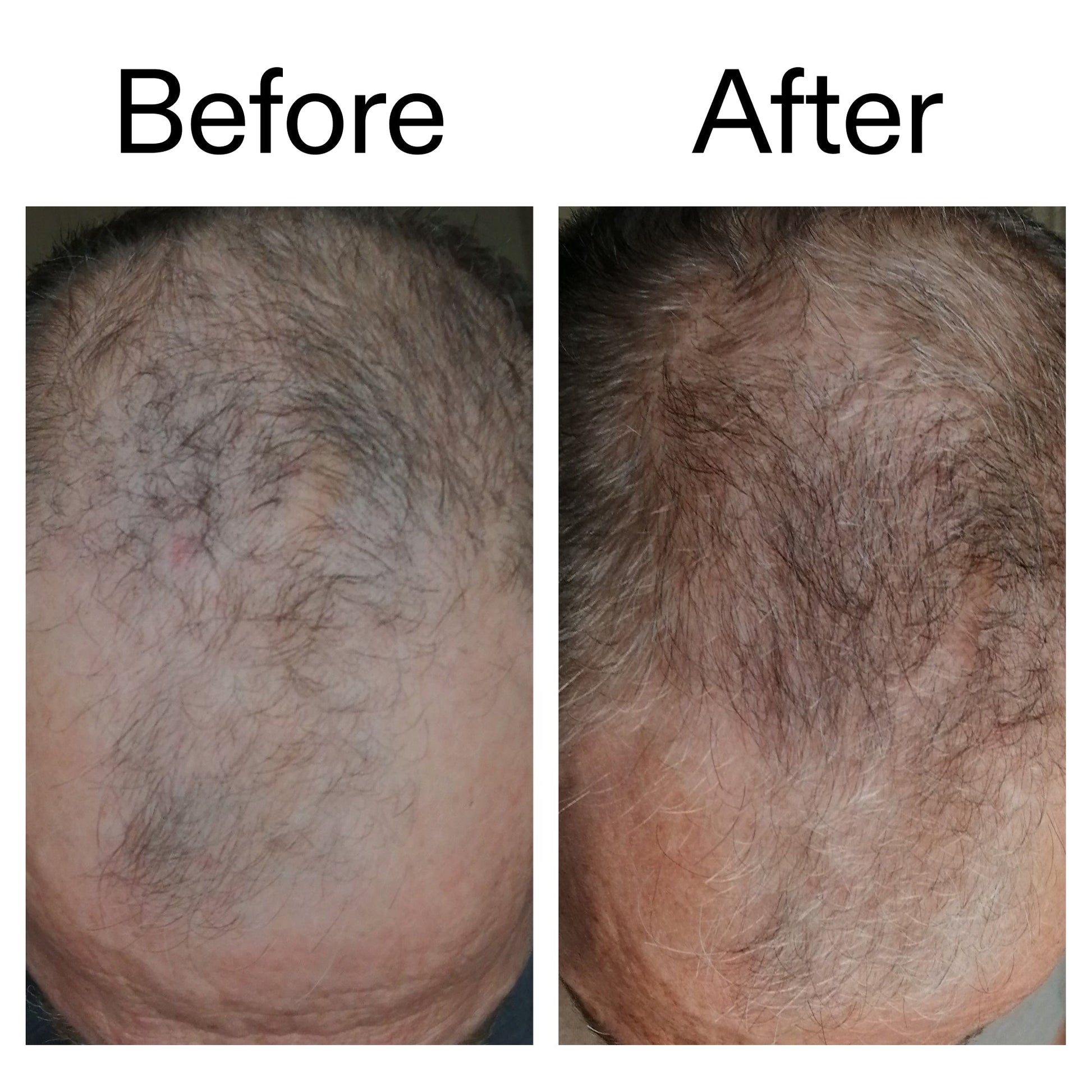 3-month-hair-growth-trio-b3 Caffeine_Scalp_Treatment_B_A_Ppage_2000_x_2000.jpg