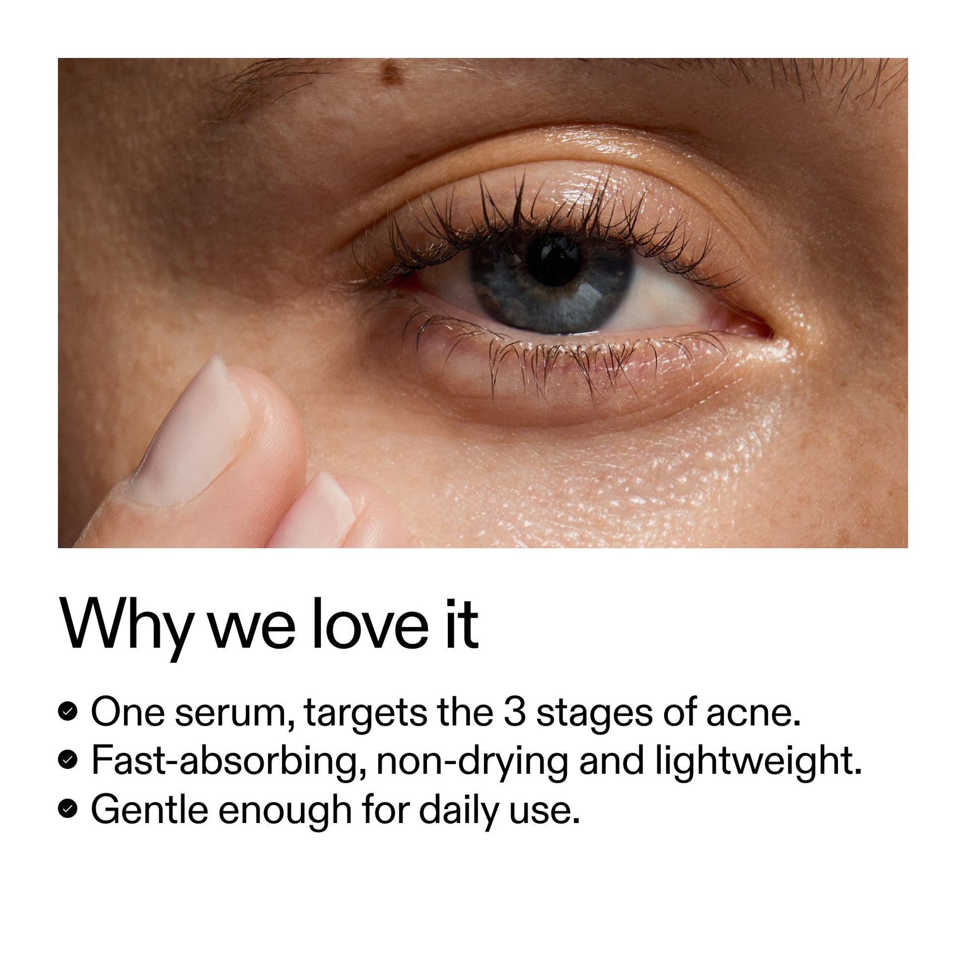 360-acne-clearing-serum-i5 Dioic_Whyweloveit_2000x2000_175aafd3-0cbe-403a-b317-a8362881bfe2.jpg