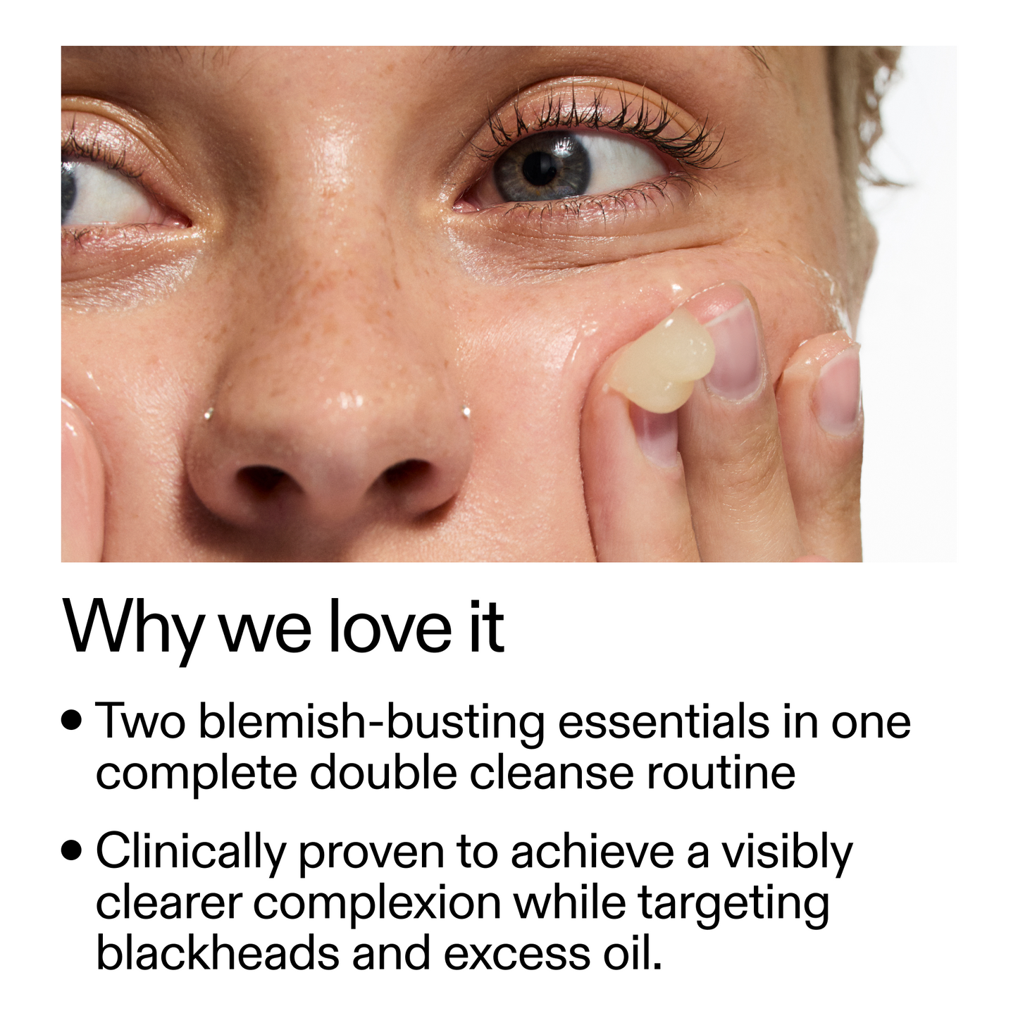 acne-double-cleanse-duo-f1 Double_Cleanse_Duo_for_Breakouts_Why_We_2000x2000_f242cb12-bb5c-487c-b203-071ccb406ec5.png