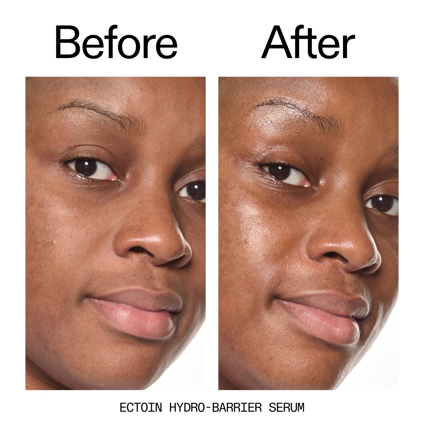 barrier-boosting-trio-q3 Ectoin_Before_After_2000x2000_ce35bc41-4da0-4b6f-adc7-29f8641f6c6c.jpg