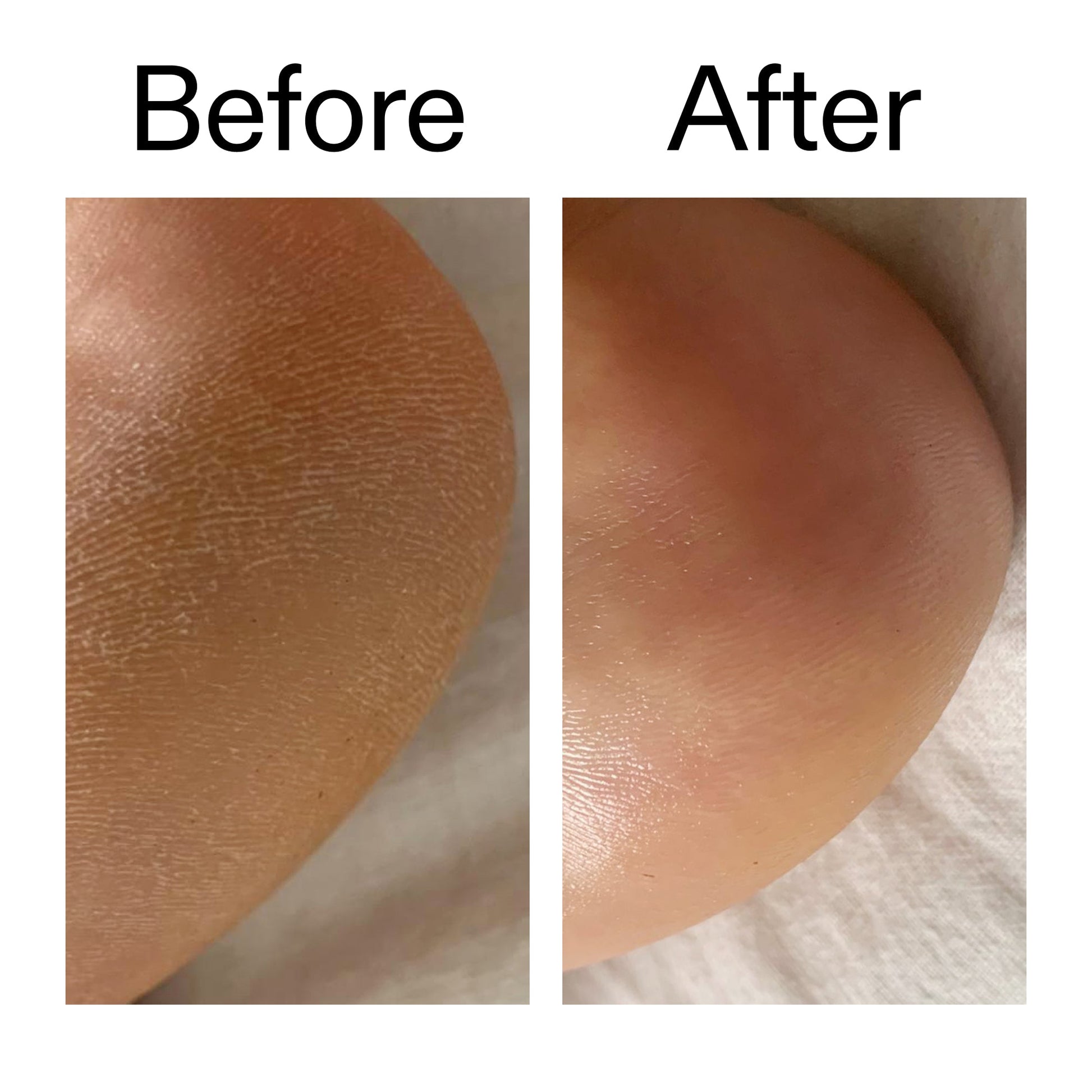 glycolic-acid-exfoliating-body-stick-duo-p7 Glycolic_Acid_Exfoliating_Body_Stick_Before_After_V1_2000x2000_a3043625-9400-429a-a7fb-d6dbd220f722.jpg