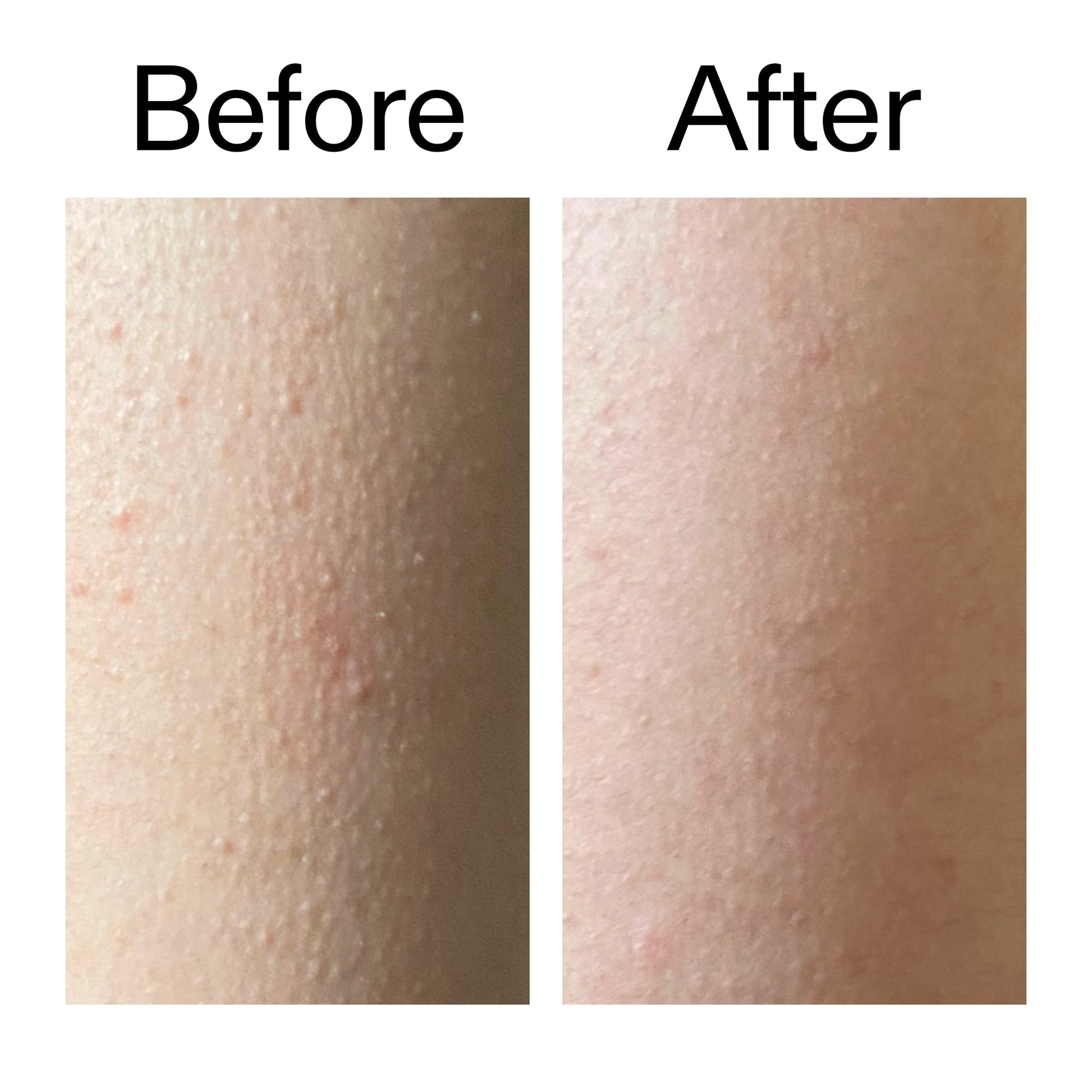 glycolic-acid-exfoliating-body-stick-w7 Glycolic_Acid_Exfoliating_Body_Stick_Before_After_V2_2000x2000_2e4ba052-94f6-4d56-82df-7bdb5b2df7ae.jpg