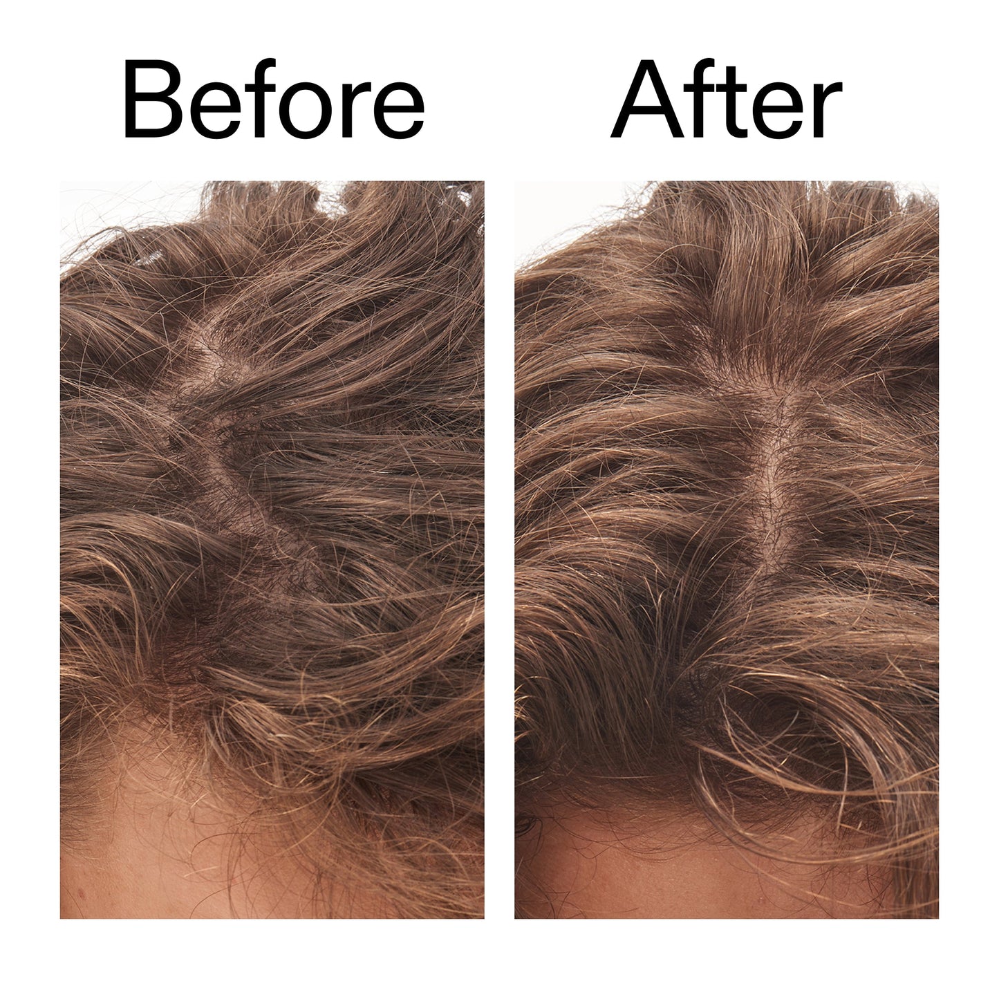 glycolic-acid-exfoliating-scalp-scrub-h5 Glycolic_Acid_Exfoliating_Scalp_Scrub_Before_After_2000x2000_b8561c87-05a1-4caa-80f7-1b6b33d750f7.jpg
