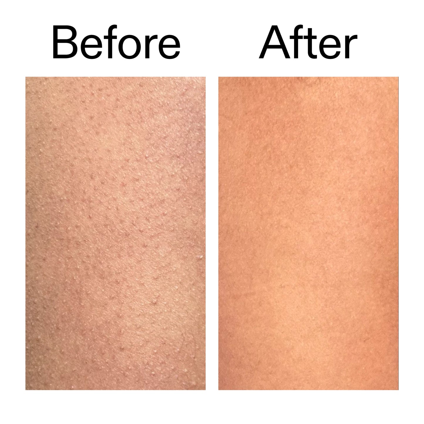 glycolic-acid-exfoliating-body-stick-duo-p7 Glycolic_Body_Stick_B_A_2000x2000_6e6e6b4d-5bd7-43c0-aeed-4d66788e8995.jpg