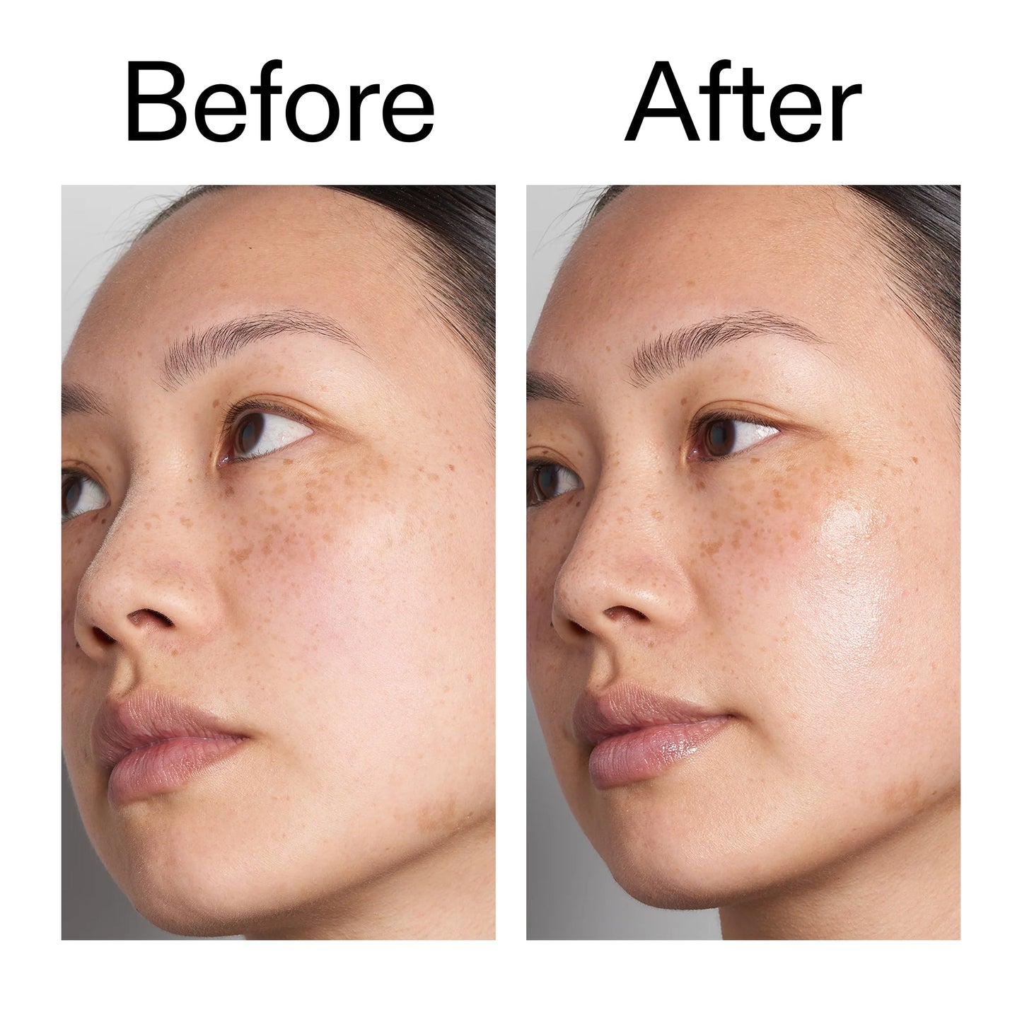 hyaluronic-acid-serum-30ml-e9 Hyaluronic_Acid_Before_After_2000x2000_d7983956-8aa2-4ea3-8255-c63e8d4f892e.jpg