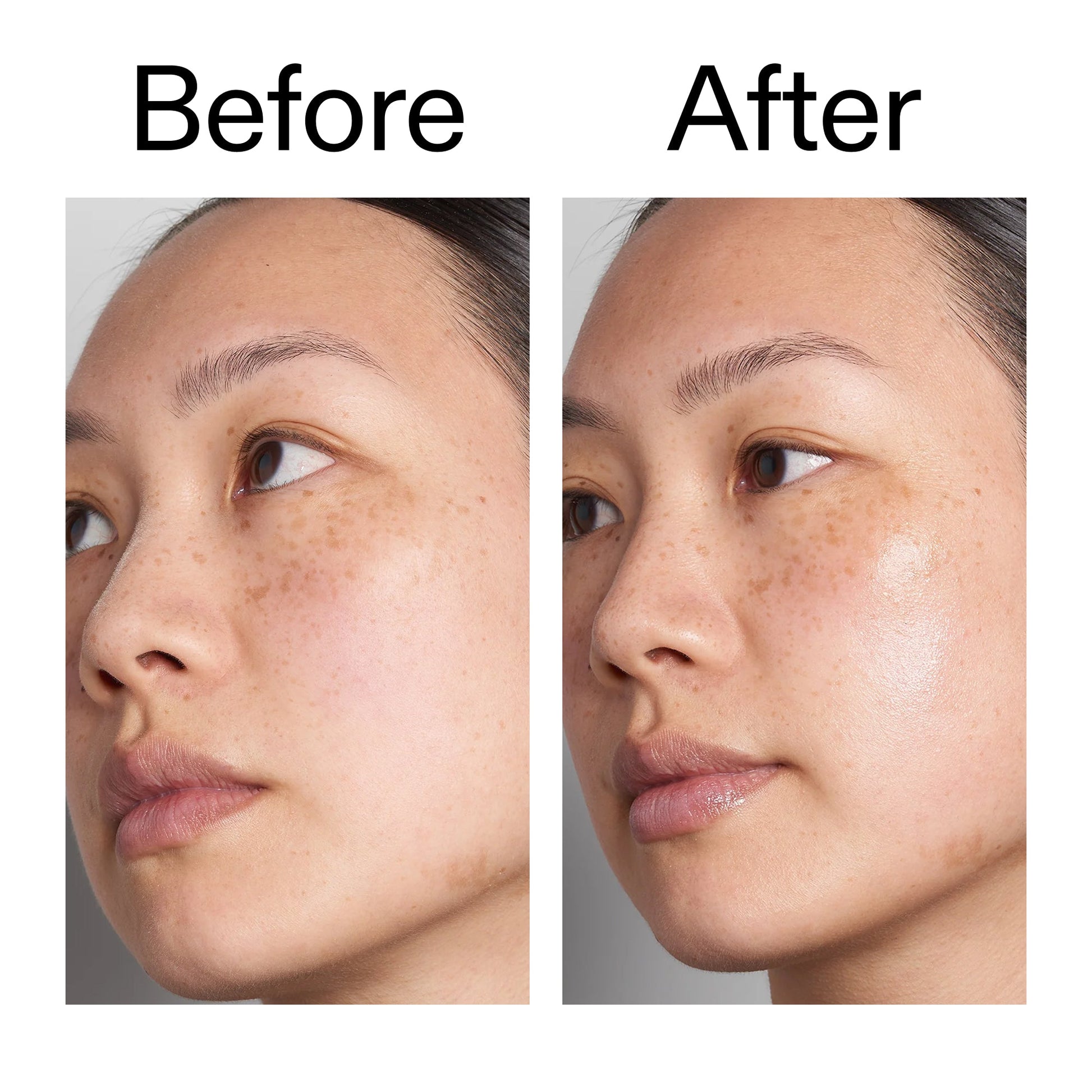 supersize-hyaluronic-acid-serum-100ml-duo-q5 Hyaluronic_Acid_Before_After_2000x2000_d7983956-8aa2-4ea3-8255-c63e8d4f892e.jpg