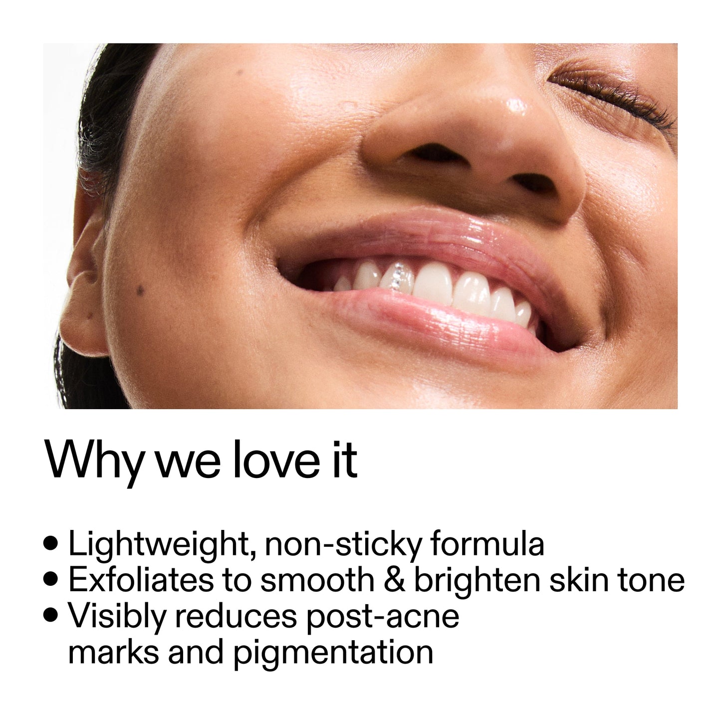 mandelic-acid-treatment-l1 Mandelic_Acid_Treatment_Why_we_love_it_2000x2000_6dfe29a9-2a79-464f-a5e8-e5ac37d93388.jpg