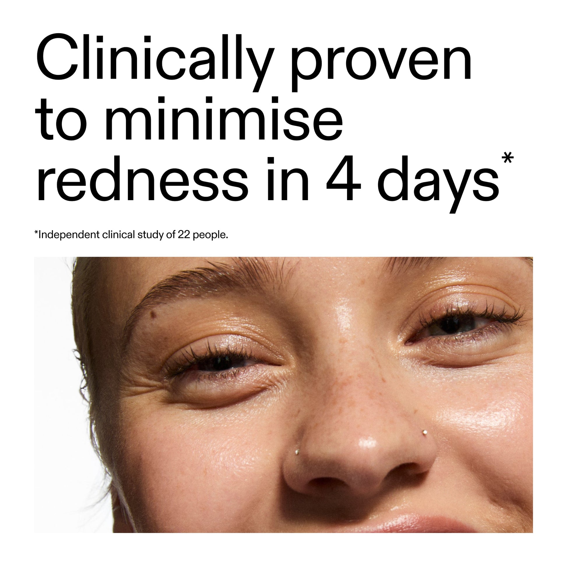 10-azelaic-acid-serum-for-redness-relief-g0 Oat_Cleansing_Balm_Claim_2000x2000_52a841dc-353c-4f2c-8646-3aadb604507d.jpg