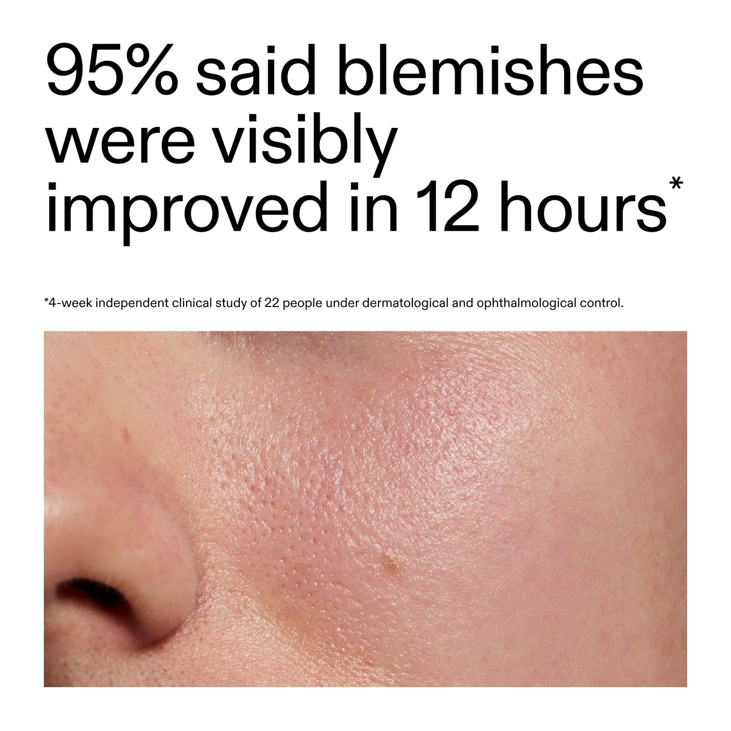 succinic-acid-acne-treatment-k6 Oat_Cleansing_Balm_Claim_2000x2000_ac6ce553-25db-41b2-a981-faae1ac4b8c0.jpg