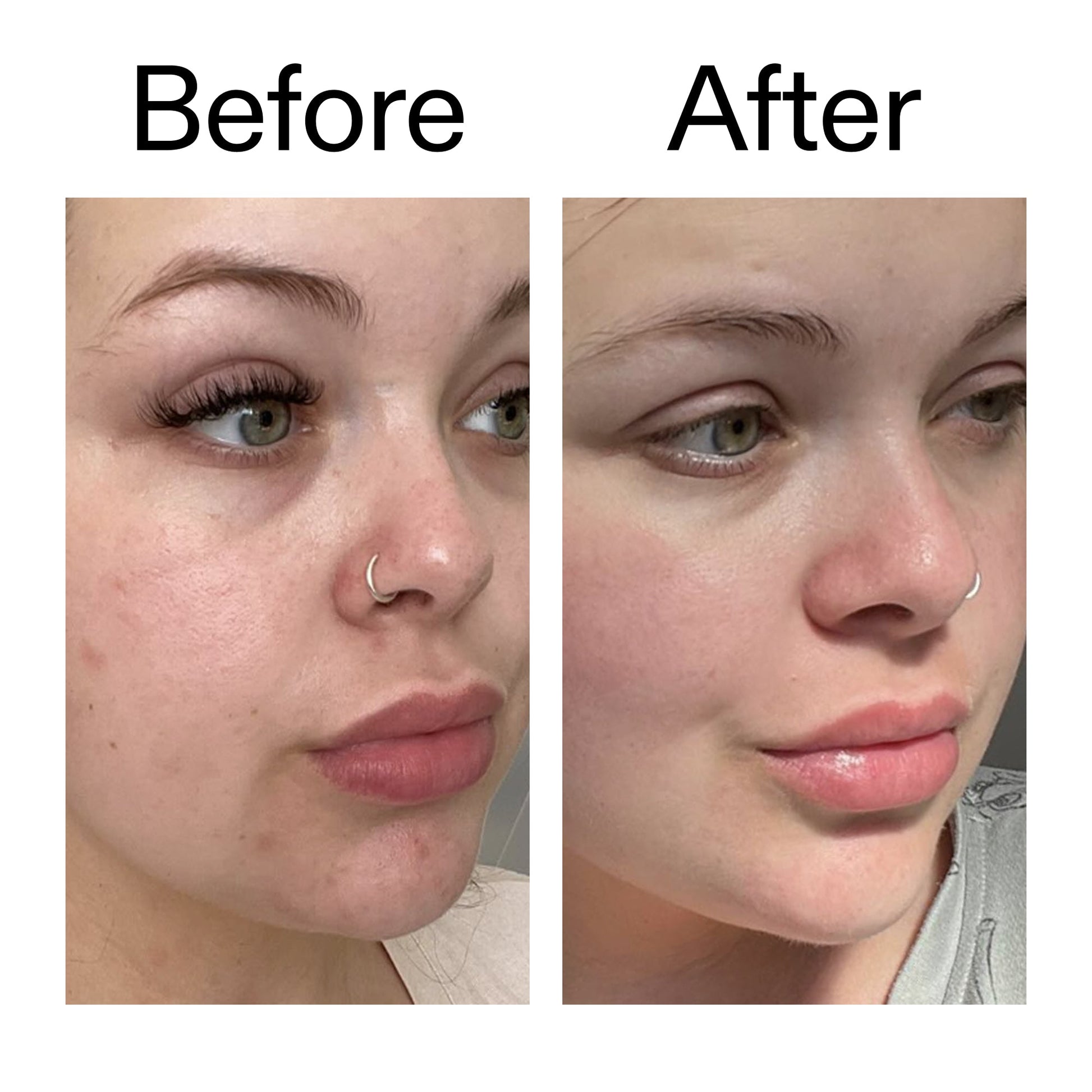 supersize-omega-water-cream-duo-r5 Omega50_Before_After_2000x2000_46483ed8-3f9d-487f-9a0c-9df79830bd65.jpg