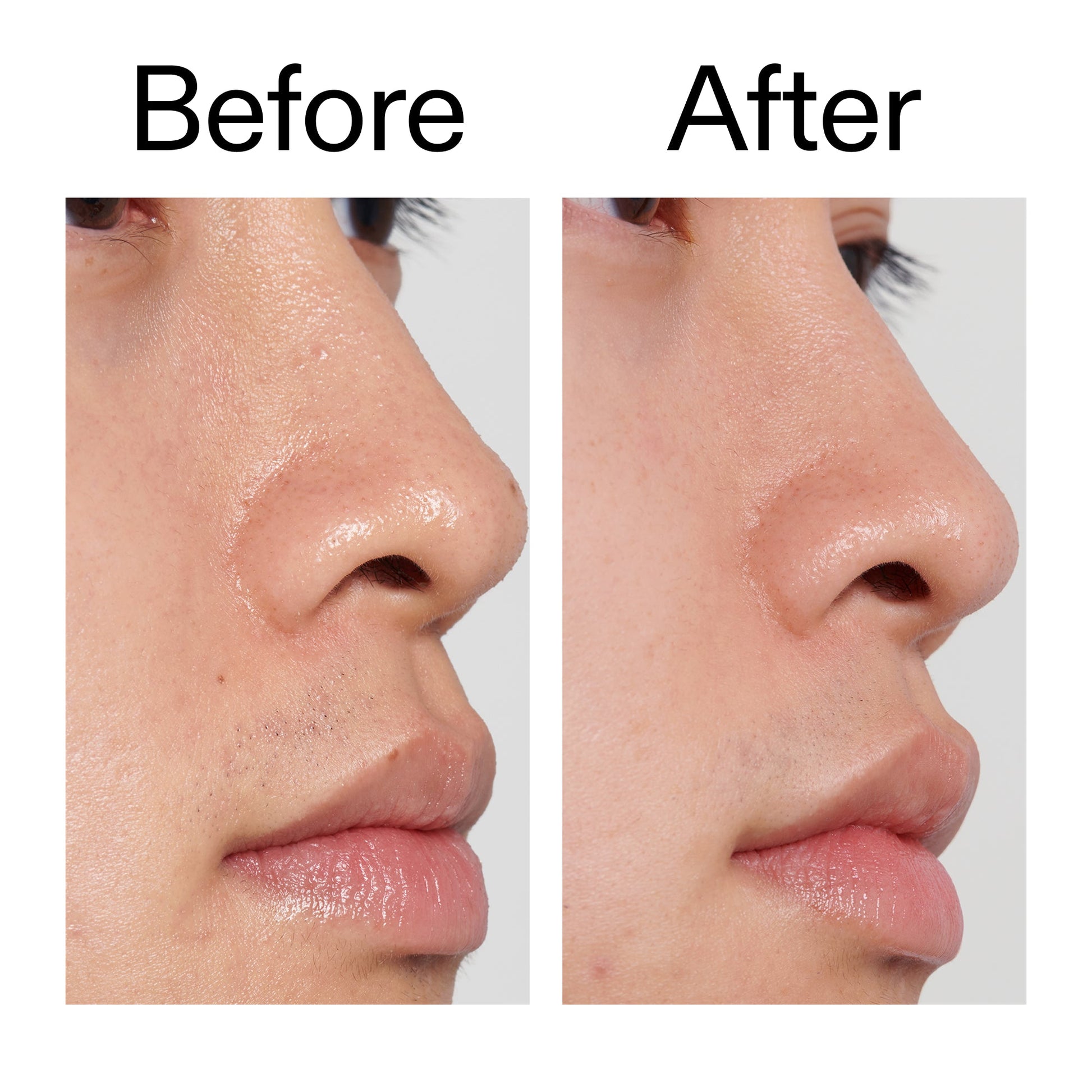 pha-toner-y2 PHA_Toner_Before_After_2000x2000_e3c10172-0150-4342-8b95-57417eaff50d.jpg