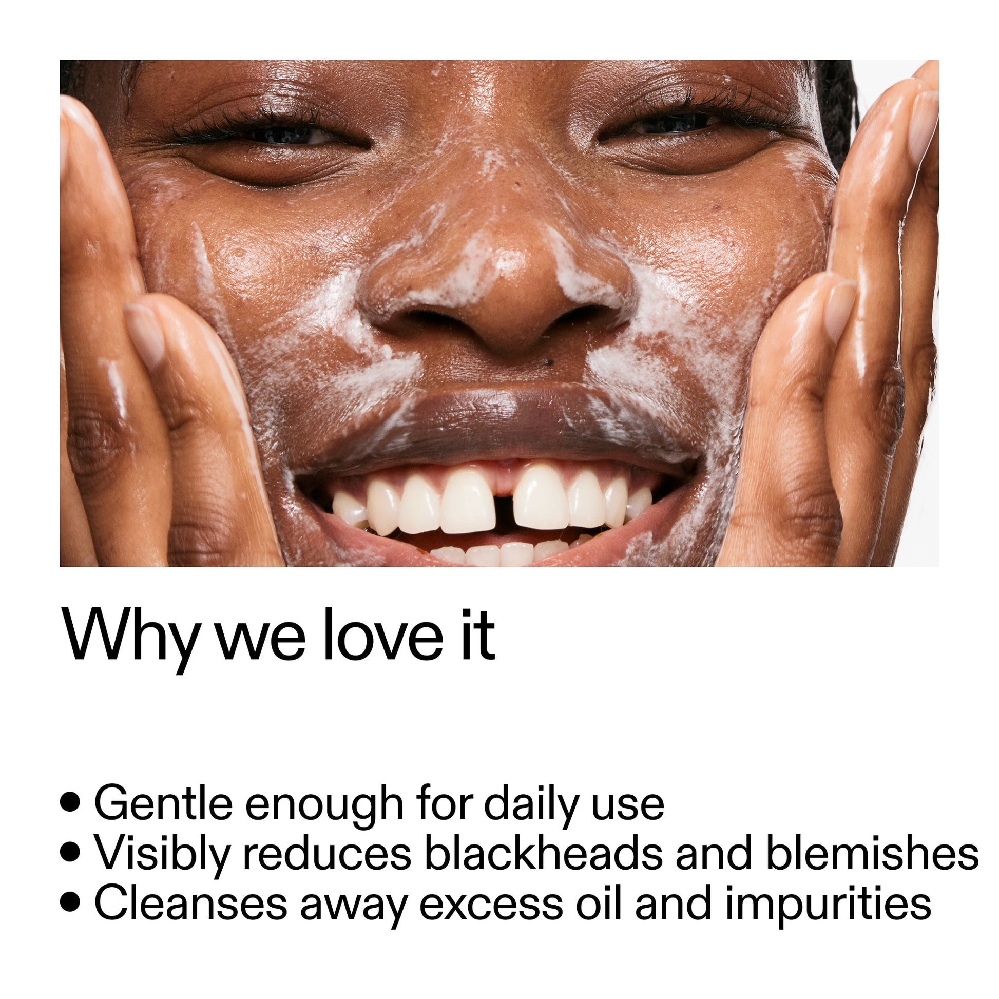 salicylic-acid-cleanser-duo-g5 Salicylic_Acid_Cleanser_-_300mlWhy_we_love_it_2000x2000_87dc92a9-2559-4309-98cd-4e570f1be735.jpg