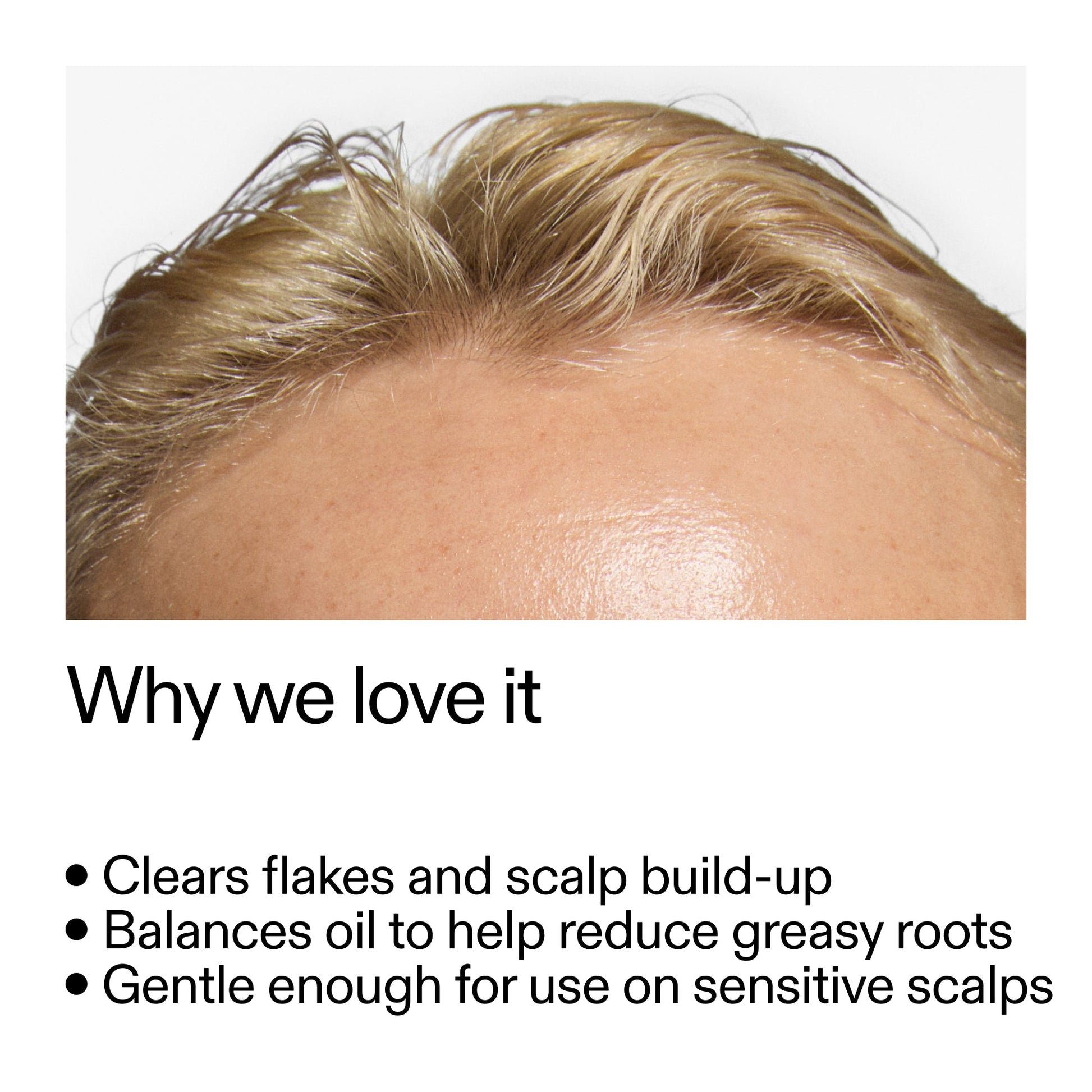 salicylic-acid-exfoliating-scalp-treatment-w8 Salicylic_Acid_Exfoliating_Scalp_Treatment_Why_we_love_it_2000x2000_44b6bd6d-9ec4-4b23-9dc4-bc3fd6f28e14.jpg