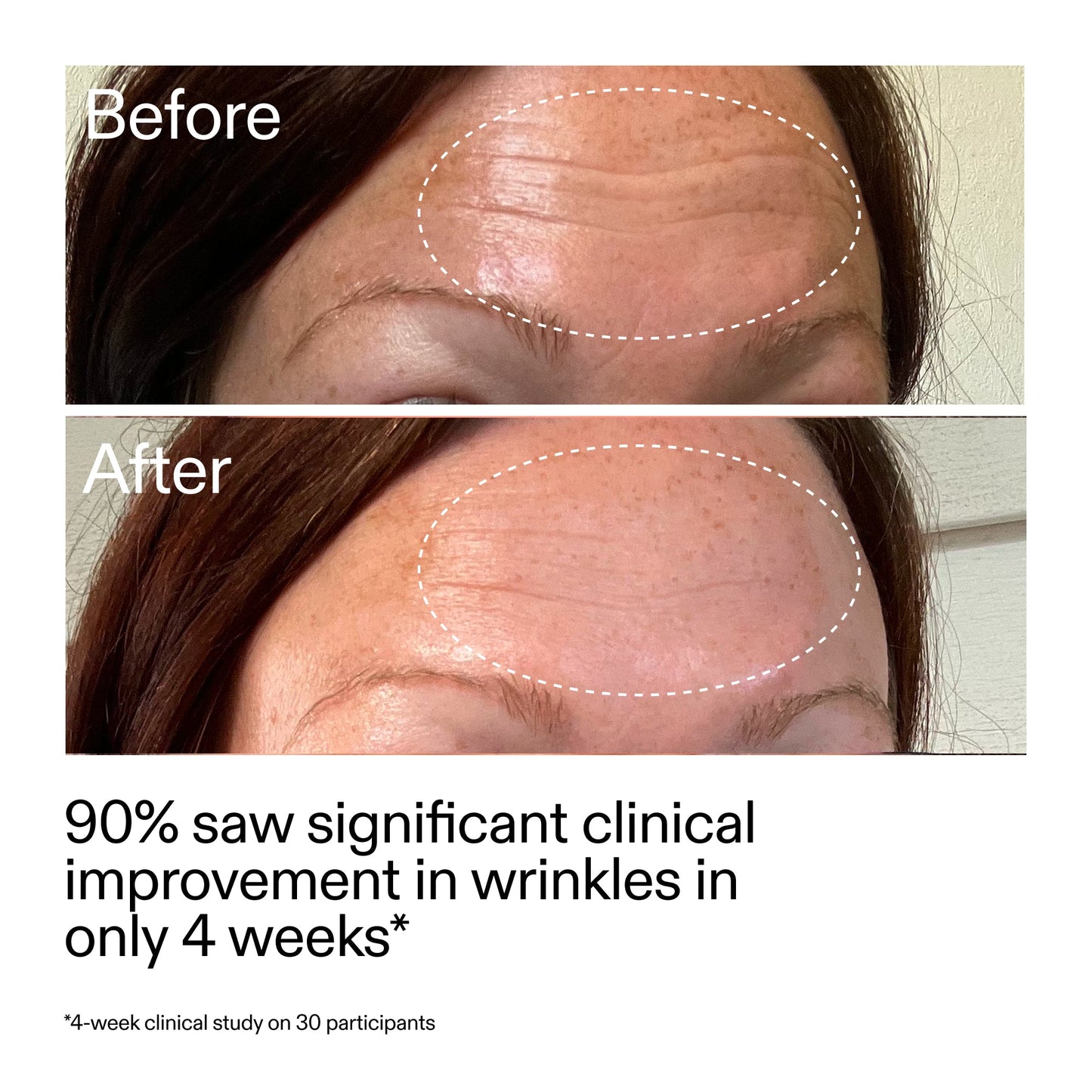 starter-retinol-serum-w1 StarterRetinol_BeforeAfter_Claim1_2000x2000_a09b50b6-4688-4527-abae-21bd142b89b7.jpg
