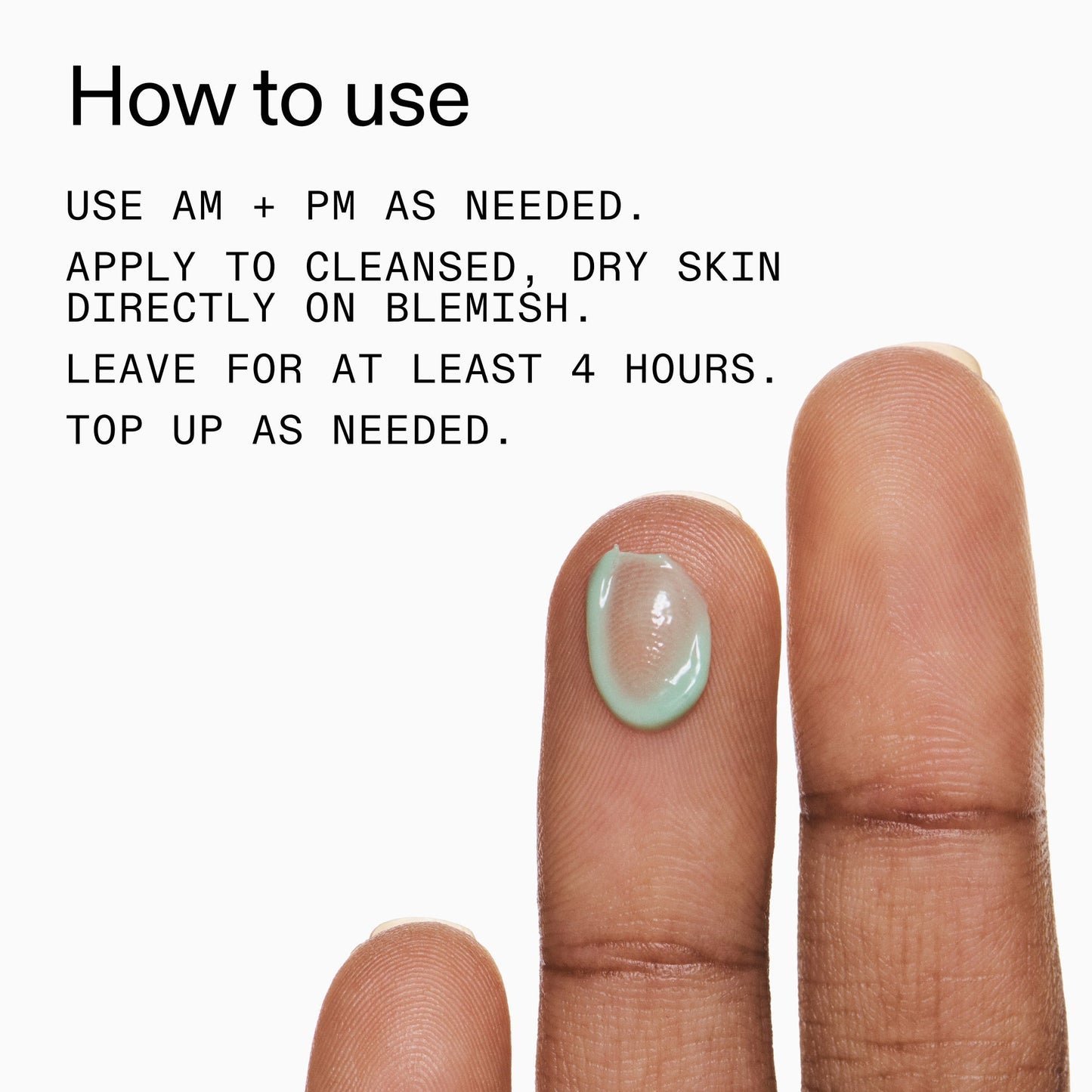 succinic-acid-acne-treatment-k6 Succinic_Acid_Treatment_How_to_Use_2000x2000_d57137d5-d7f1-427c-9a46-5fc00c19c542.jpg