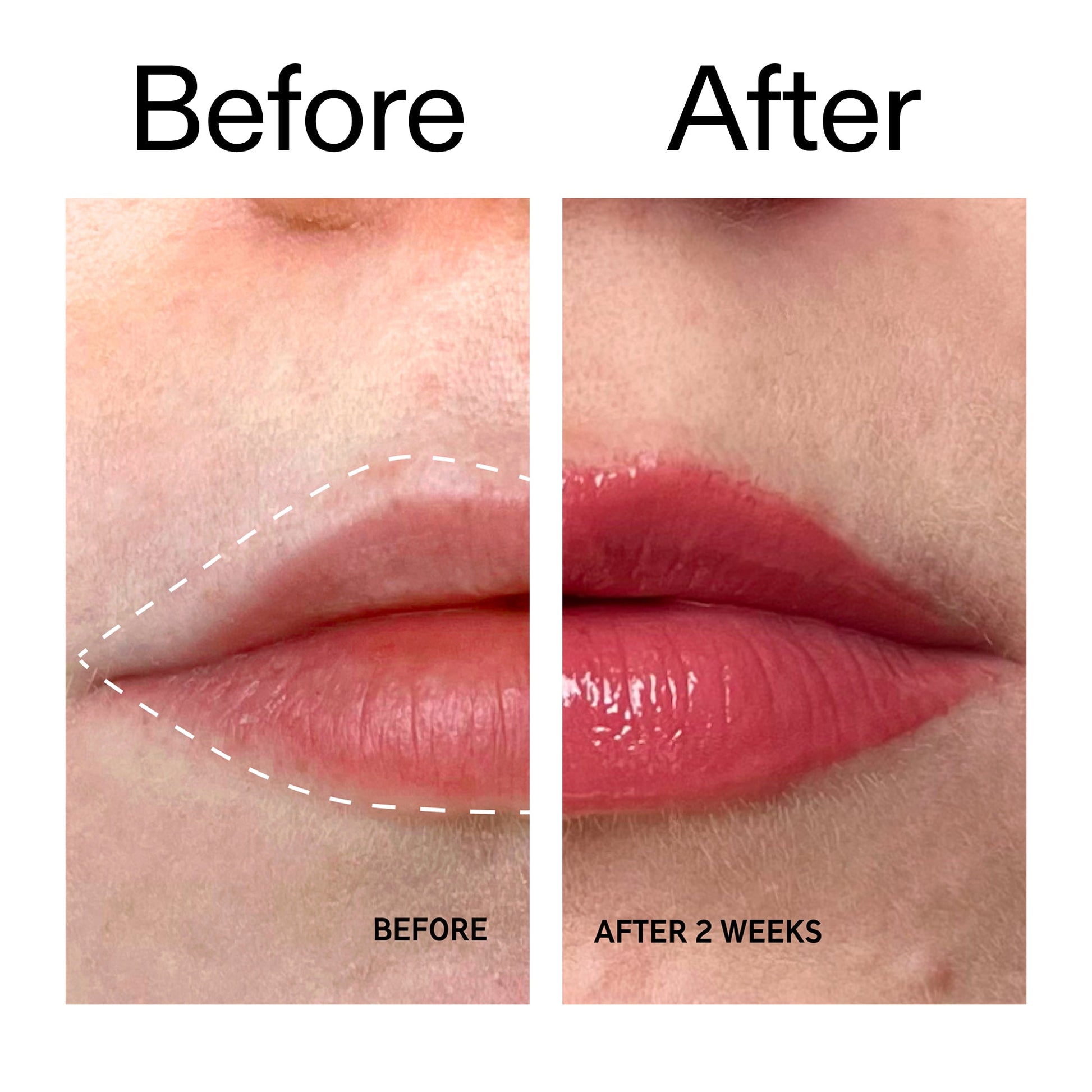 tripeptide-plumping-berry-lip-balm-t4 Tripeptide_Plumping_Lip_Balm_-_Berry_Before_After_2000x2000_9474bbd8-43ca-4b0e-b0e7-dfab70b91927.jpg