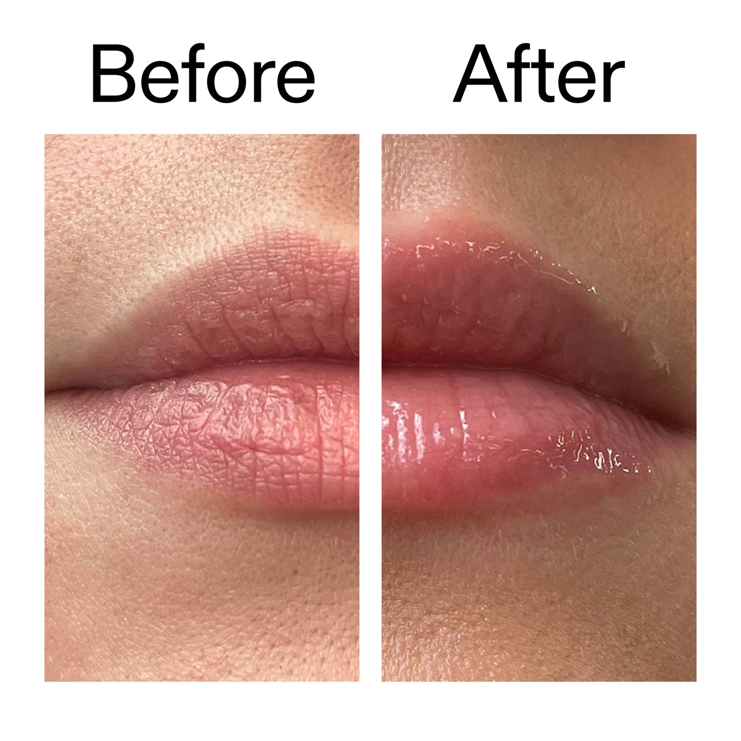 tripeptide-plumping-lip-balm-a5 Tripeptide_Plumping_Lip_Balm_Before_After_2000x2000_b4a5ee04-d2ac-4857-8f01-17209acc4bf3.jpg