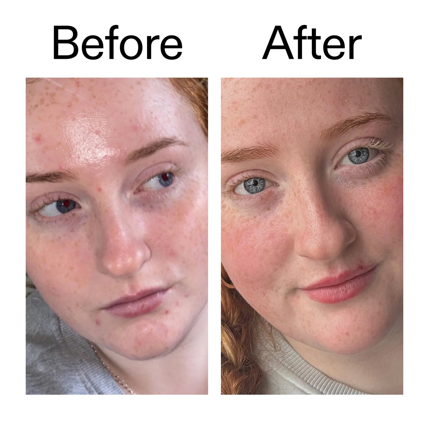 vitamin-b-c-and-e-moisturizer-r6 Vitamin_B_C_and_E_Moisturizer_Before_After_2000x2000_b0781a76-5ad2-4be9-95b8-ef92b356833c.jpg